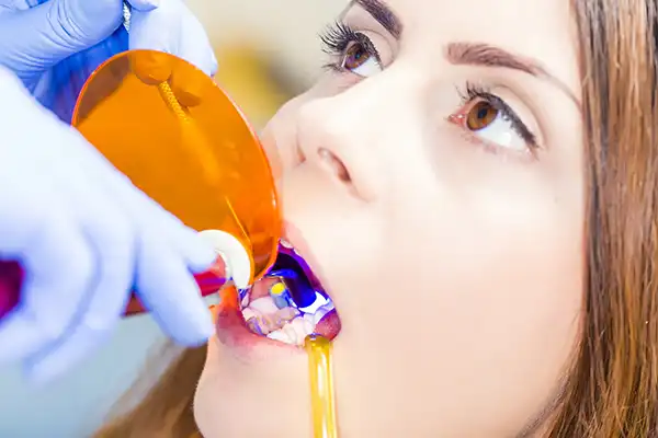 Close-up of a patient receiving a dental bonding procedure