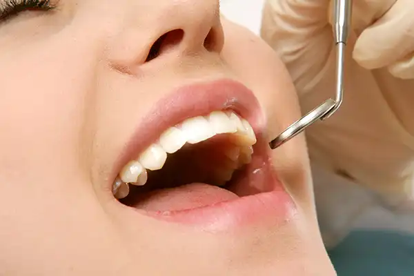 A young woman having her mouth examined with a dental mirror at Highridge Dental Care