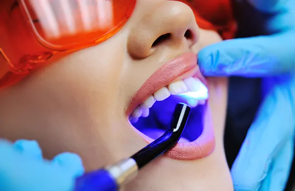 Close-up of a dental assistant applying a UV light to a patient's newly sealed teeth